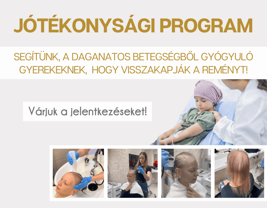 jótékonysági program